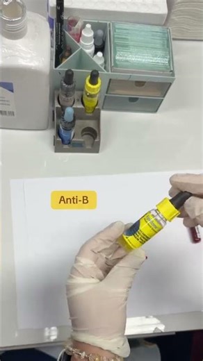 how to do blood typing? | #pharmacist #fypシ #youtubeshorts #likeandsubscribe #likesforlike #views