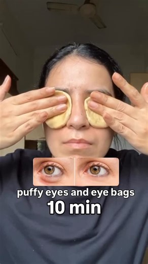 Mansi Gulati on Instagram: "Say goodbye to puffy eyes and under-eye bags instantly with this easy home remedy! All you need is: ✓ A small soft roti ball ✓ A few drops of almond oil How to use: 1️⃣ Take a fresh, warm roti and roll it into a soft ball 2️⃣ Add 2–3 drops of almond oil 3️⃣ Place it gently on your eyes 4️⃣ Leave for 10–15 minutes This helps in: ✓ Reducing under-eye puffiness ✓ Improving circulation ✓ Relaxing tired eyes ✓ Softening fine lines Instant freshness, instant glow! ✨ 👉 Join