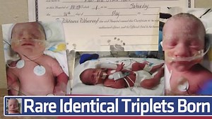 56K views · 996 reactions | It's a 1 in 50 million chance. Rare identical triplets - two of which are conjoined - are born. Rebecca Jarvis reports #Facecast | ABC World News Tonight with David Muir | Facebook