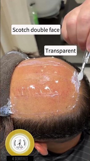 Collage Mixte pour prothèse capillaire #hairstyletutorial #hairloss