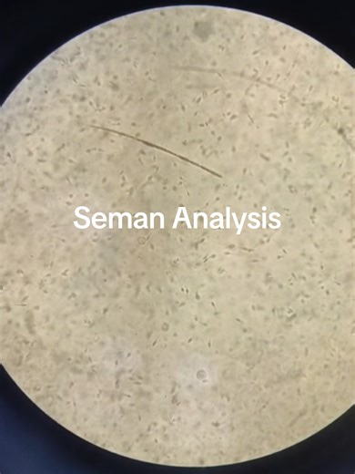 Understanding Semen Analysis: A Comprehensive Guide
