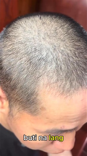 😭 Every time you wash your hair, hair falls out all over the floor, dandruff falls like snow? ❌ A light touch and a handful of hair comes out? ❌ Your pillow is full of fallen hair? ❌ Your hair is thinning, revealing your scalp, making you look older than your actual age? 👉All of this will end, your hair will grow back thanks to DHT shampoo: https://only1legit.shopdubainow.store/hair-care 💸 ONE SPA VISIT = ONE BOTTLE OF SHAMPOO THAT LASTS A MONTH ✅ Week 1: Stops hair loss, helps hair smooth an