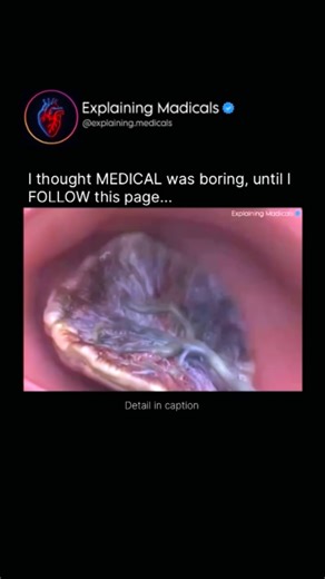 Medical | Health | Anatomy | Although the placenta grows inside the mother’s body, it is not made from her cells. Biologically, the placenta develops from the... | Instagram