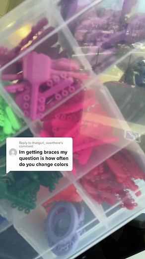 Choosing Braces Colors: A Fun Orthodontist Experience
