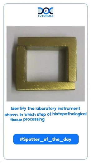 Spotter of the Day | DocTutorials MBBS