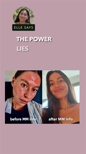 I Tried So Many Creams To Heal My Skin - Here's What Actually Works