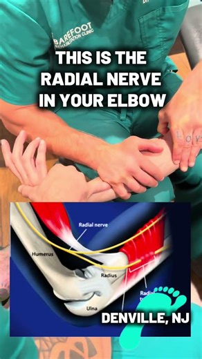 That Elbow Pain Might Be a Stuck Nerve
