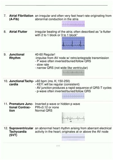 Basic DysrhythmiaRelias