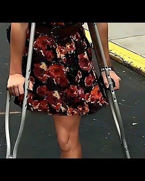 The beautiful woman with an amputated leg and walking with crutches defies disability and is brave