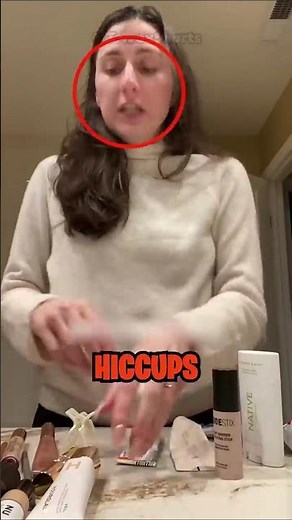 How To Cure Hiccups INSTANTLY 😱