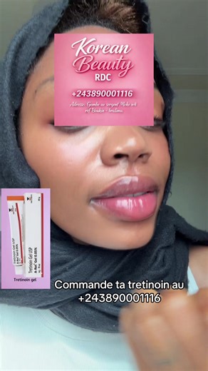 243890001116 Adresse : Gombe av sergent Moke n 4 réf rond point Safricas #kinshasa🇨🇩 #mboka_elengi🇨🇩😂😂 #congolaise🇨🇩 #congolaise🇨🇩🇨🇬 #congolaise🇨🇩243🇨🇬242feu🔥