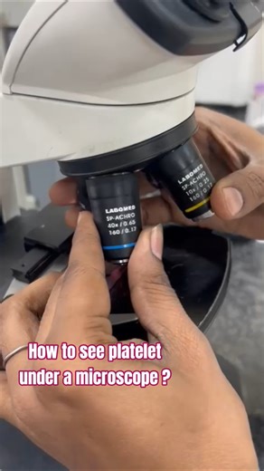 How to see platelet under a microscope ? #sewa #labteach #science #plateletcount