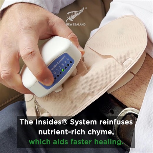 From stomach pain to surgery recovery, New Zealand HealthTech is making care feel less scary and more supportive 💜 Wearable gut tests instead of endoscopies – Alimetry. Sheep-based tech that supports complex wound healing – Aroa. Reusing your own nutrients to aid recovery after bowel surgery – The Insides Company. | Eyes On New Zealand