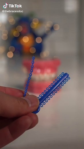 Understanding Power Chains in Orthodontics