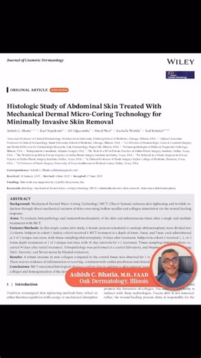 ellacor on Instagram: "✨ Histologic Study of Abdominal Skin Treated With Mechanical Dermal Micro-Coring Technology for Minimally Invasive Skin Removal highlights by Ashish C. Bhatia, MD This study further supports the science behind Ellacor’s dermal micro-coring technology—demonstrating real, histologic evidence of tissue removal and natural healing without thermal injury. 🔬💡 #Ellacor #Cytrellis #Microcoring #DermalMicroCoring #ClinicalEvidence #SkinScience #AestheticInnovation #
