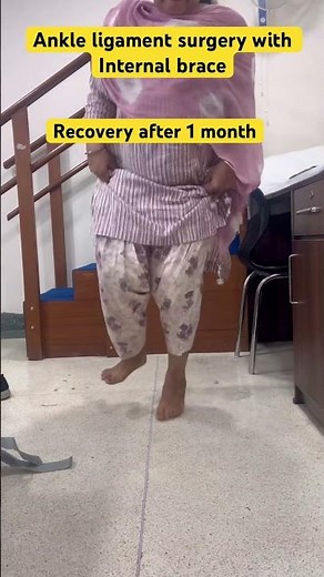 Atfl ligament surgery with internal brace ( fibre tape ) / Results after 1 month | Dr Chandan Narang