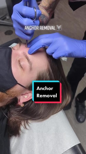 Super quick one removing a surface anchor (“dermal piercing”) on a coworker #piercing #fyp #dermalpiercing #safepiercing