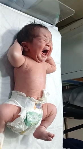 NG Tube Insertion for NICU Babies