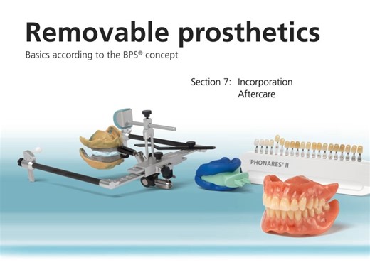 【BPS】生物功能性义齿修复系统 EP7 临床戴终义齿｜Dental Forever