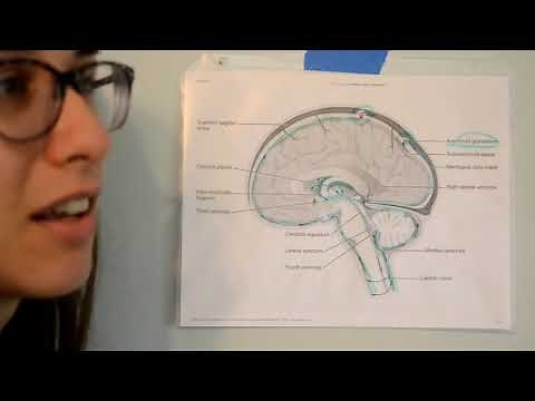 CPT vs PCS for a VP Shunt