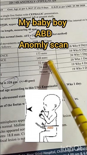 ABD in Anomaly Scan | What is ABD in Pregnancy Ultrasound? Full Explanation