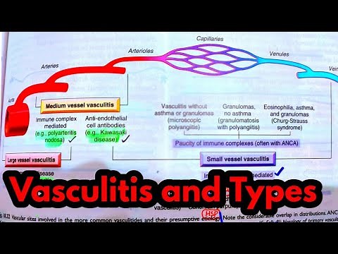 Vasculitis and its Types |Types of Vasculitis| Vasculitis ROBBINS|Blood vessels Robbins Pathology