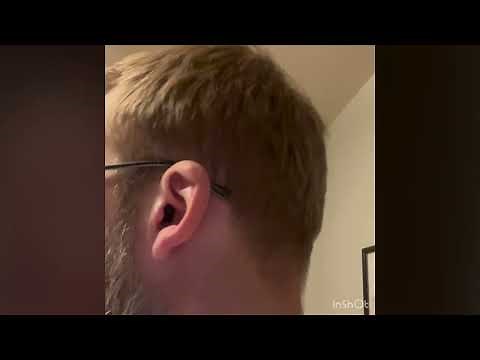 Signia Silk Charge&Go IX Review [Real User]