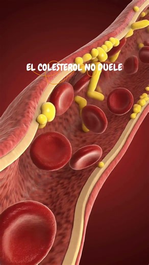 EL COLESTEROL NO DUELE