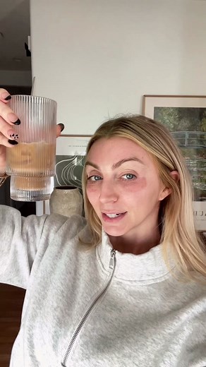 Day 3 TCA Under Eye Peel for Wrinkles Recovery