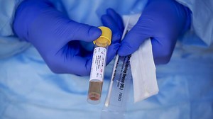 Look Up Your State's COVID-19 Test Results With This Tracker