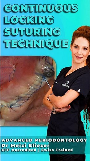 Continuous Locking Suturing Technique