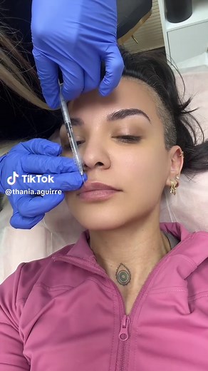 Understanding the Lip Flip Procedure