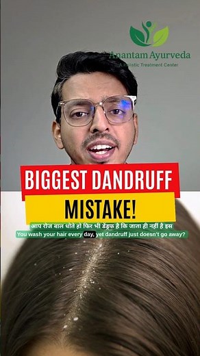 Dandruff Never Goes Away? Real Reason & FAST Solution (Doctor Explains)