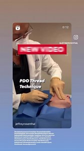 PDO threads, lip fillers, Face fillers Sculpting