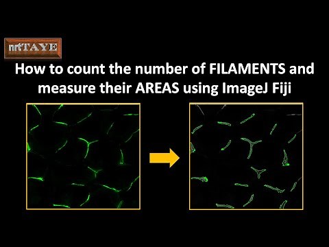 How to count the number of FILAMENTS and measure their AREAS using ImageJ Fiji