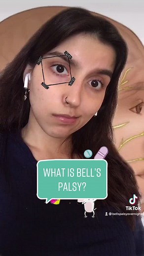 Explaining BELL’s PALSY! 🤪 #bellspalsy #recovery #paralyzed #myface #wellshit #learnontiktok #viral