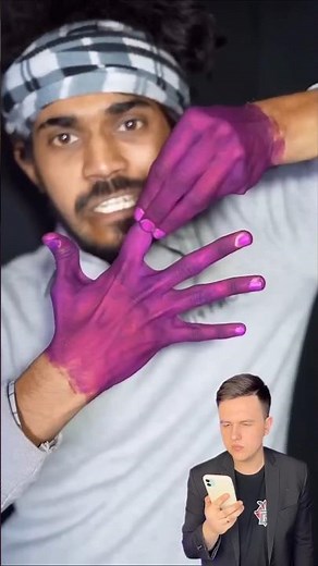 "When Magic Cuts My Finger… Then Heals It Instantly! 😳🪄"