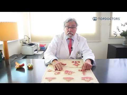 Síntomas de la hiperplasia benigna de próstata