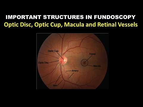 Fundoscopy | Optic Disc, Optic Cup, Macula and Retinal Vessels