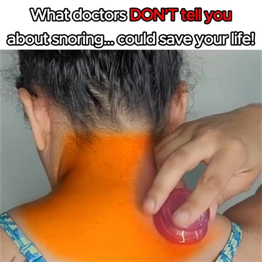 Think nose strips help with snoring? Think again. 😨 Most men don’t know this but snoring has nothing to do with your nose, pillow placement, sleeping position or even weight… There is a hidden muscle that is responsible for 97% of snoring. Watch the video and find out how to control snoring in just one night 😴 | DreamerSelect