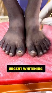 1.2M views · 6.7K reactions | ✅ Urgent Feet Dirt & Tanning Removal Pack . . . #pedicure #feetcleaningtips #FeetCare #manicure #diybeauty #diybeautytips #skincare #fbreelsfypシ゚viralvideo #fbreelsfypシ゚viralvideo #reelsviralシfb #reelschallenge #everyonefollowers #explorepage | Back to nature remedy | Facebook