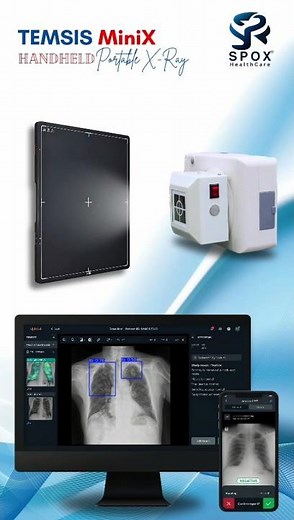 TEMSIS MiniX | Handheld Portable X-Ray Machine with AI Reporting | SPOX Healthcare India