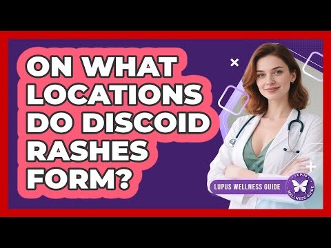 On What Locations Do Discoid Rashes Form?