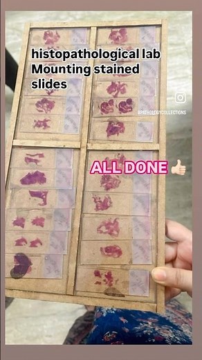 HISTOPATHOLOGICAL LAB /MOUNTING STAINED SLIDES/DPX/EASY SLIDES MOUNTING 🪢PERMANENT BOND