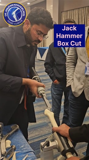 Dr. Anupam Khandelwal Joint Clinics | *Hip Replacement Surgery* THIGH BONE PREPARATION 1️⃣ Femoral neck cut Accurate neck osteotomy to restore length, offset, and... | Instagram