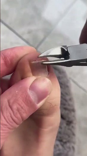 Best Clipper For Trimming Ingrown Toenails 🦶✂️