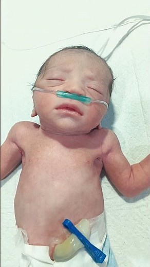 Newborn Baby Warmer Care in NICU | Thermal Care | Nursing Education