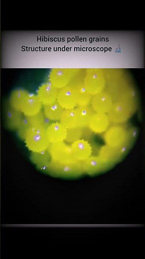 Hibiscus Pollen Grains Under Microscope 🔬 | Amazing Microscopic View of Flower Pollen