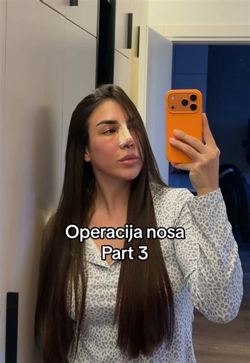 Polako ali sigurno gubim strpljenje 🤣