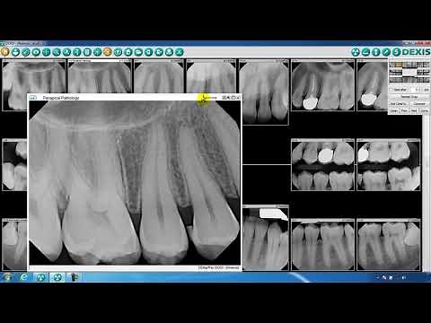 DEXIS™ Imaging Suite Image and Navigator Overview